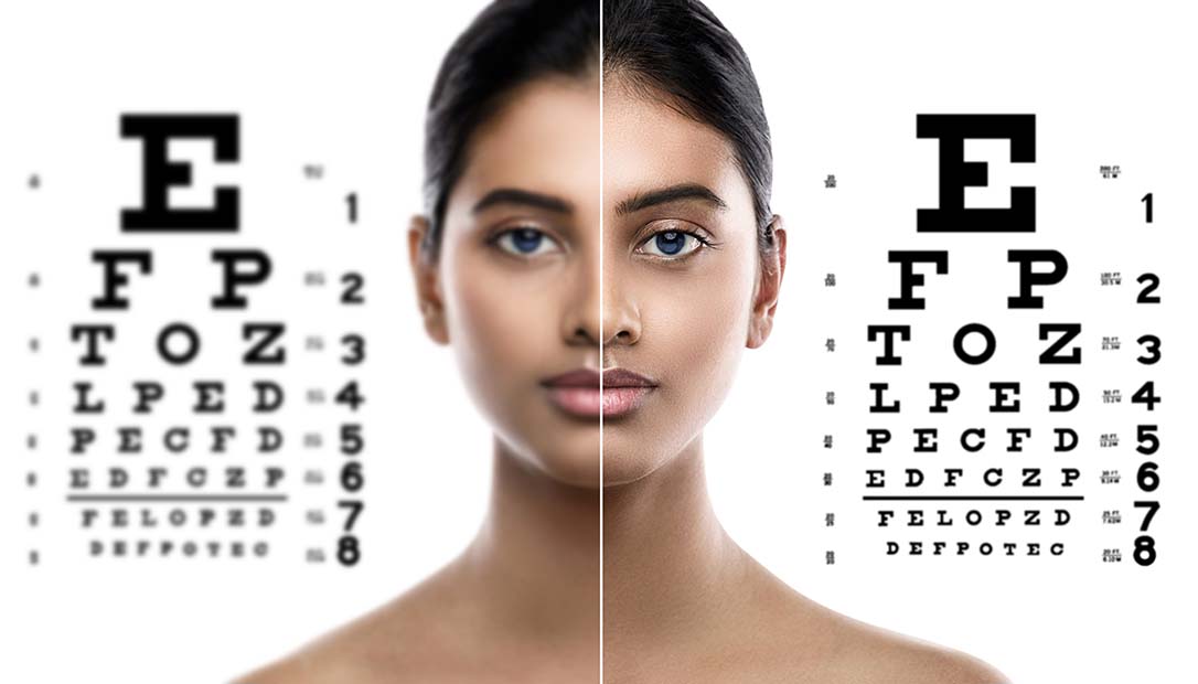 Improved Eye Site with Lasik